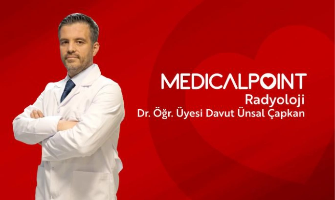 Medical Point Gaziantep Hastanesi’nden Kalp Krizine Karşı Erken Tanı Hamlesi